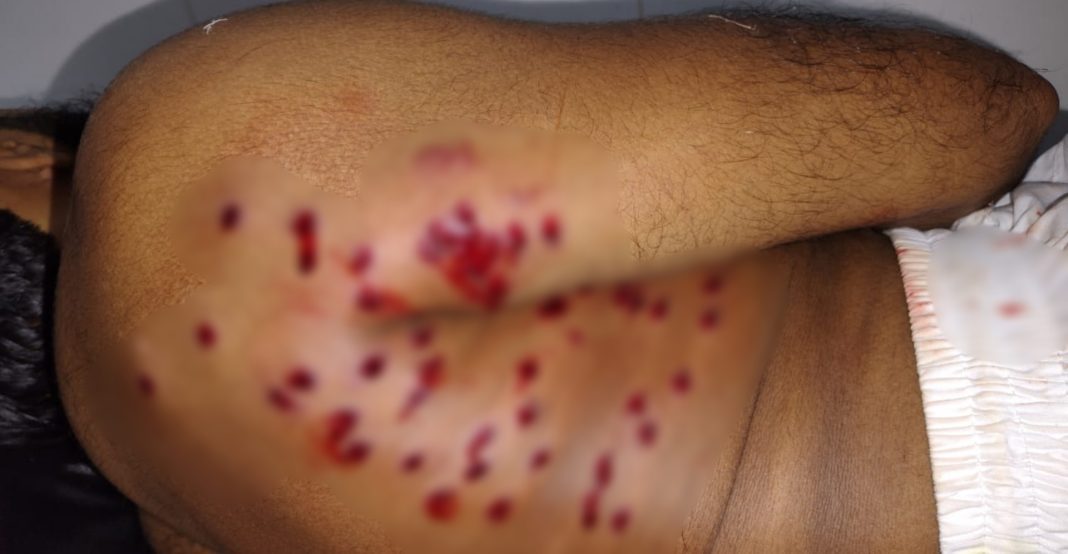 নোয়াখালীতে মোটরসাইকেল ছিনতাই করতে মাদরাসা শিক্ষককে গুলি 