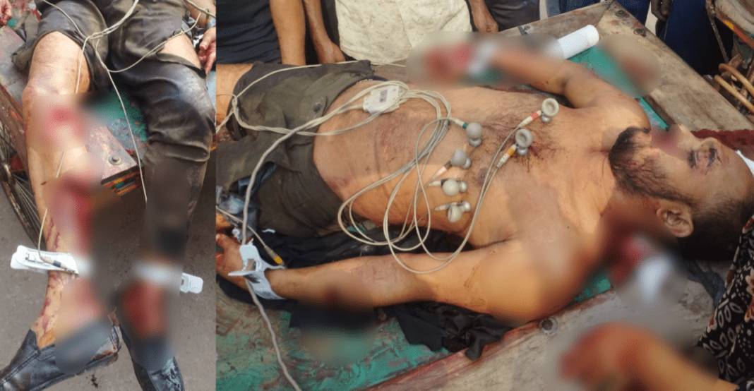 যশোর ঝিকরগাছায় যুবদল কর্মিকে কুপিয়ে হত্যা করেছে দুর্বৃত্তরা